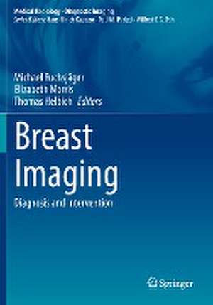 Breast Imaging: Diagnosis and Intervention de Michael Fuchsjäger