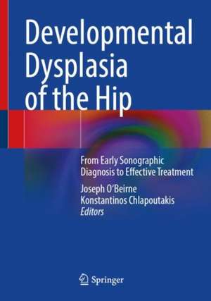 Developmental Dysplasia of the Hip: From Early Sonographic Diagnosis to Effective Treatment de Joseph O'Beirne