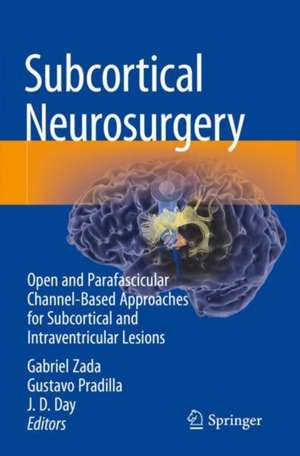 Subcortical Neurosurgery: Open and Parafascicular Channel-Based Approaches for Subcortical and Intraventricular Lesions de Gabriel Zada