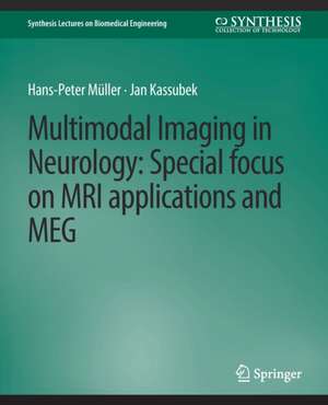 Multimodal Imaging in Neurology: Special Focus on MRI Applications and MEG de Hans-Peter Müller