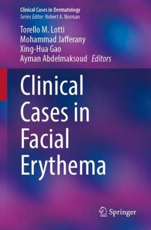 Clinical Cases in Facial Erythema de Torello M. Lotti