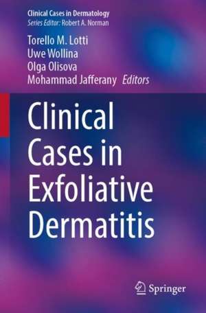 Clinical Cases in Exfoliative Dermatitis de Torello M. Lotti