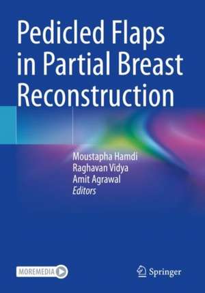 Pedicled Flaps in Partial Breast Reconstruction de Moustapha Hamdi