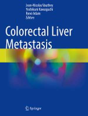 Colorectal Liver Metastasis de Jean-Nicolas Vauthey