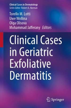 Clinical Cases in Geriatric Exfoliative Dermatitis de Torello M. Lotti