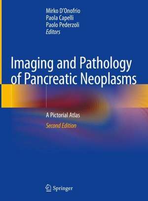 Imaging and Pathology of Pancreatic Neoplasms: A Pictorial Atlas de Mirko D'Onofrio