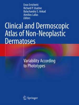 Clinical and Dermoscopic Atlas of Non-Neoplastic Dermatoses: Variability According to Phototypes de Enzo Errichetti