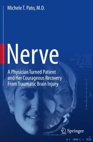 Nerve de Michele T. Pato