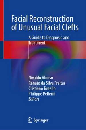 Facial Reconstruction of Unusual Facial Clefts: A Guide to Diagnosis and Treatment de Nivaldo Alonso