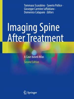 Imaging Spine After Treatment: A Case-based Atlas de Tommaso Scarabino