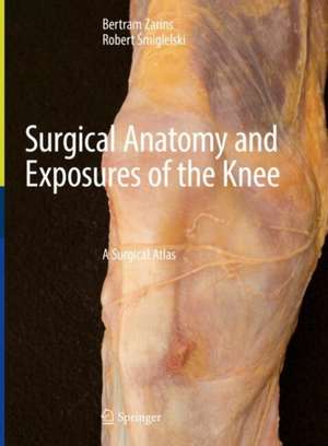 Surgical Anatomy and Exposures of the Knee: A Surgical Atlas de Bertram Zarins