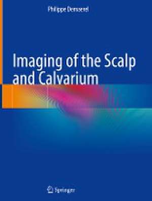 Imaging of the Scalp and Calvarium de Philippe Demaerel