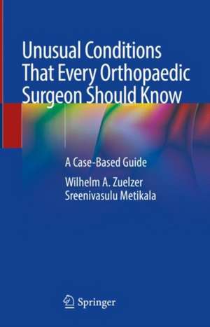 Unusual Conditions That Every Orthopedic Surgeon Should Know: A Case-Based Guide de Wilhelm A. Zuelzer