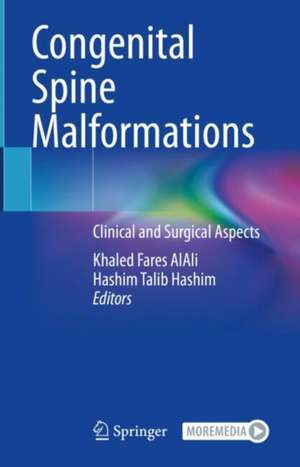 Congenital Spine Malformations: Clinical and Surgical Aspects de Khaled Fares AlAli