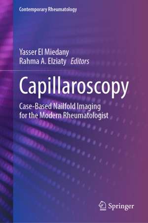 Capillaroscopy de Rahma A. Elziaty