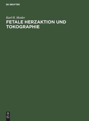 Fetale Herzaktion und Tokographie: Ultrasonographie - Atlas für die Geburtshilfe de Karl H. Mosler