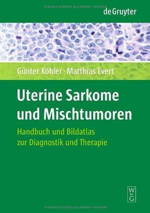 Uterine Sarkome und Mischtumoren: Handbuch und Bildatlas zur Diagnostik und Therapie de Günter Köhler