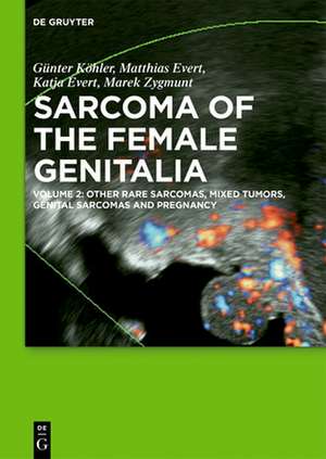 Sarcoma of the Female Genitalia / [Set Vol. I+II] Bd. Volume 1+2 de Günter Köhler