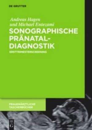 Sonographische Pränataldiagnostik de Andreas Hagen