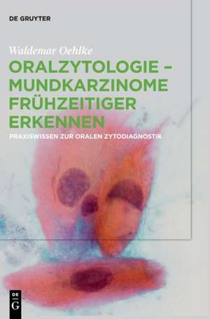 Oralzytologie - Mundkarzinome frühzeitiger erkennen de Waldemar Oehlke