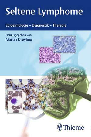Seltene Lymphome de Martin Dreyling