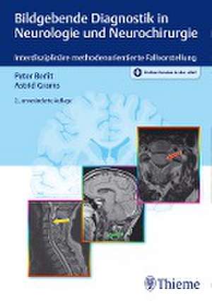 Bildgebende Diagnostik in Neurologie und Neurochirurgie de Peter-Dirk Berlit