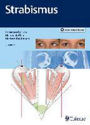 Strabismus de Herbert Kaufmann