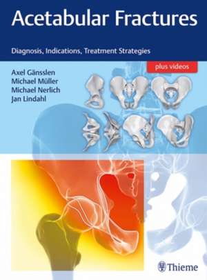 Acetabular Fractures – Diagnosis, Indications, Treatment Strategies de Axel Gänsslen