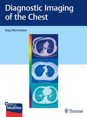 Diagnostic Imaging of the Chest alte