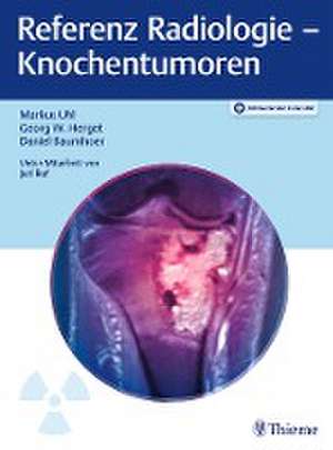 Referenz Radiologie - Knochentumoren de Markus Uhl