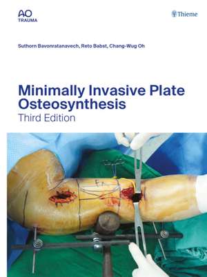 Minimally Invasive Plate Osteosynthesis de Suthorn Bavonratanavech