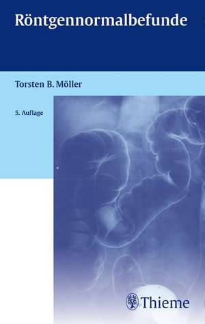 Röntgennormalbefunde de Torsten Bert Möller