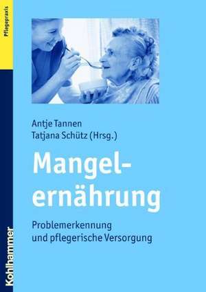 Mangelernahrung: Problemerkennung Und Pflegerische Versorgung de Antje Tannen