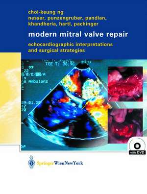 Modern Mitral Valve Repair: Echocardiographic Interpretations and Surgical Strategies de Christian Punzengruber