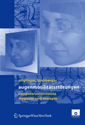 Augenmotilitätsstörungen: Computerunterstütze Diagnose und Therapie de Siegfried Priglinger