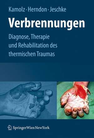 Verbrennungen: Diagnose, Therapie und Rehabilitation des thermischen Traumas de Lars-Peter Kamolz