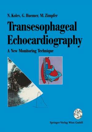 Transesophageal Echocardiography: A New Monitoring Technique de Nikolai Kolev