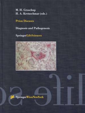 Prion Diseases: Diagnosis and Pathogenesis de Martin H. Groschup