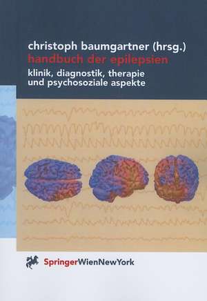 Handbuch der Epilepsien: Klinik, Diagnostik, Therapie und psychosoziale Aspekte de Christoph Baumgartner