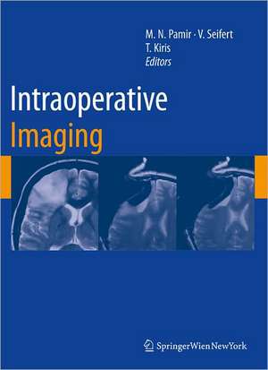 Intraoperative Imaging de M. Necmettin Pamir