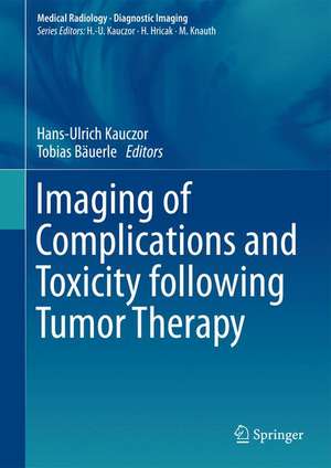 Imaging of Complications and Toxicity following Tumor Therapy de Hans-Ulrich Kauczor