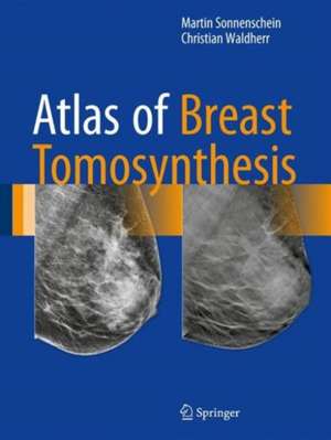 Atlas of Breast Tomosynthesis: Imaging Findings and Image-Guided Interventions de Martin Sonnenschein