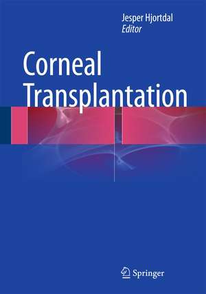 Corneal Transplantation de Jesper Hjortdal