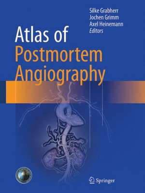 Atlas of Postmortem Angiography de Silke Grabherr