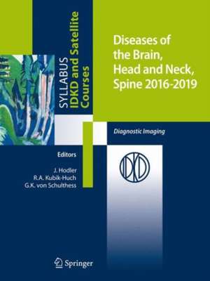 Diseases of the Brain, Head and Neck, Spine 2016-2019: Diagnostic Imaging de Jürg Hodler