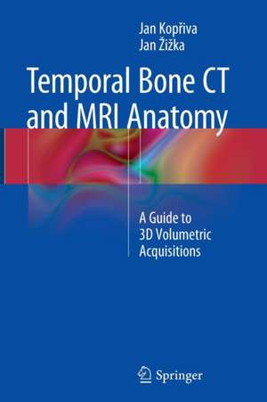 Temporal Bone CT and MRI Anatomy: A Guide to 3D Volumetric Acquisitions de Jan Kopřiva