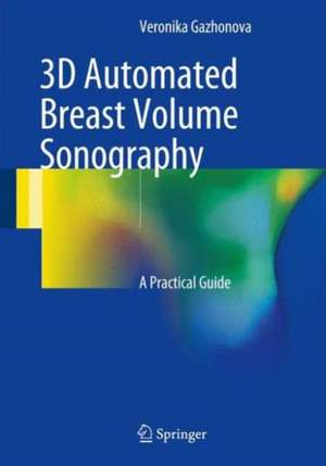 3D Automated Breast Volume Sonography: A Practical Guide de Veronika Gazhonova