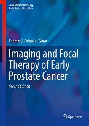 Imaging and Focal Therapy of Early Prostate Cancer de Thomas J. Polascik