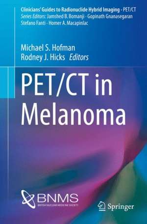 PET/CT in Melanoma de Michael S. Hofman