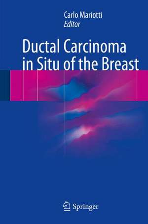 Ductal Carcinoma in Situ of the Breast de Carlo Mariotti